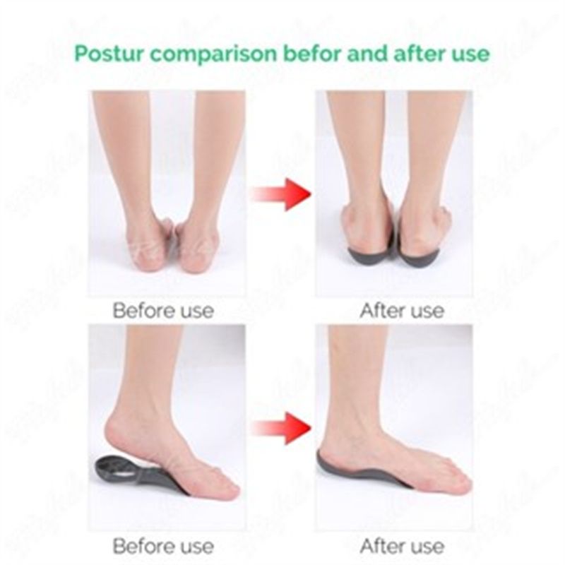 Orthopedic Insoles Orthotics Flat Foot Health Sole Pad for Shoes Insert Arch Support Pad for Feet Care Insoles Unisex