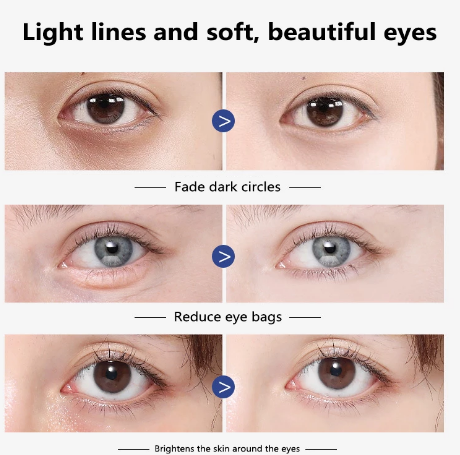 Cream with vitamin A, anti-wrinkle cream, anti-aging, removes dark circles, cares for eyes against puffiness and bags B2-619