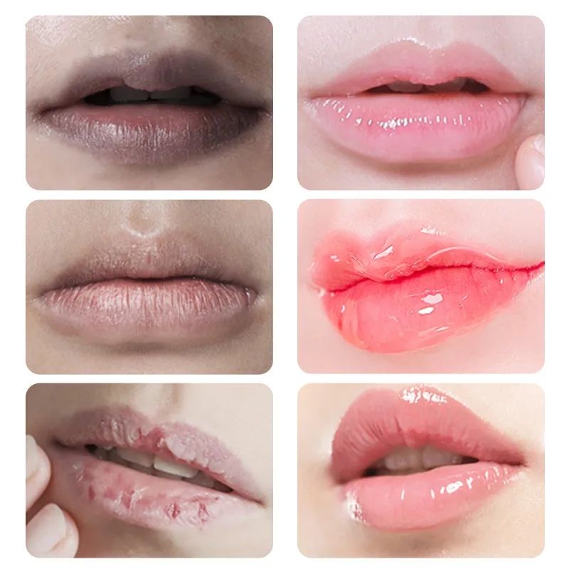 Fast Lightening Pink Mouth Lips Serum Bleaching Permanent Pinkish Moisturizing Lighten Dark Lip Balm Gloss Lipstick Lip Mask13ML B2-916