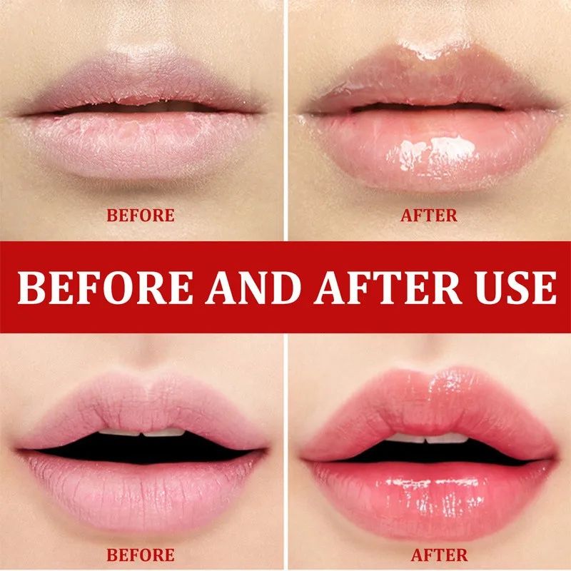 Fast Lightening Pink Mouth Lips Serum Bleaching Permanent Pinkish Moisturizing Lighten Dark Lip Balm Gloss Lipstick Lip Mask13ML B2-916