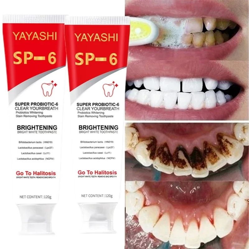 Sp-6 Probiotic Toothpaste For Whitening & Fresh Breath - Deep Cleaning, Stain Removal, Paraben-Free, Ideal For Home & Travel B2-971