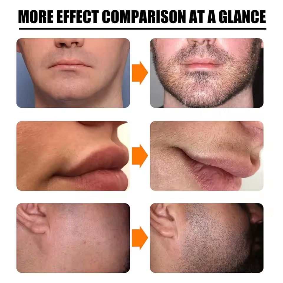 Natural Organic Men Beard Growth Oil Beard Wax balm Hair Loss Products Leave-In Conditioner for Groomed Beard Growth 30ml B2-60