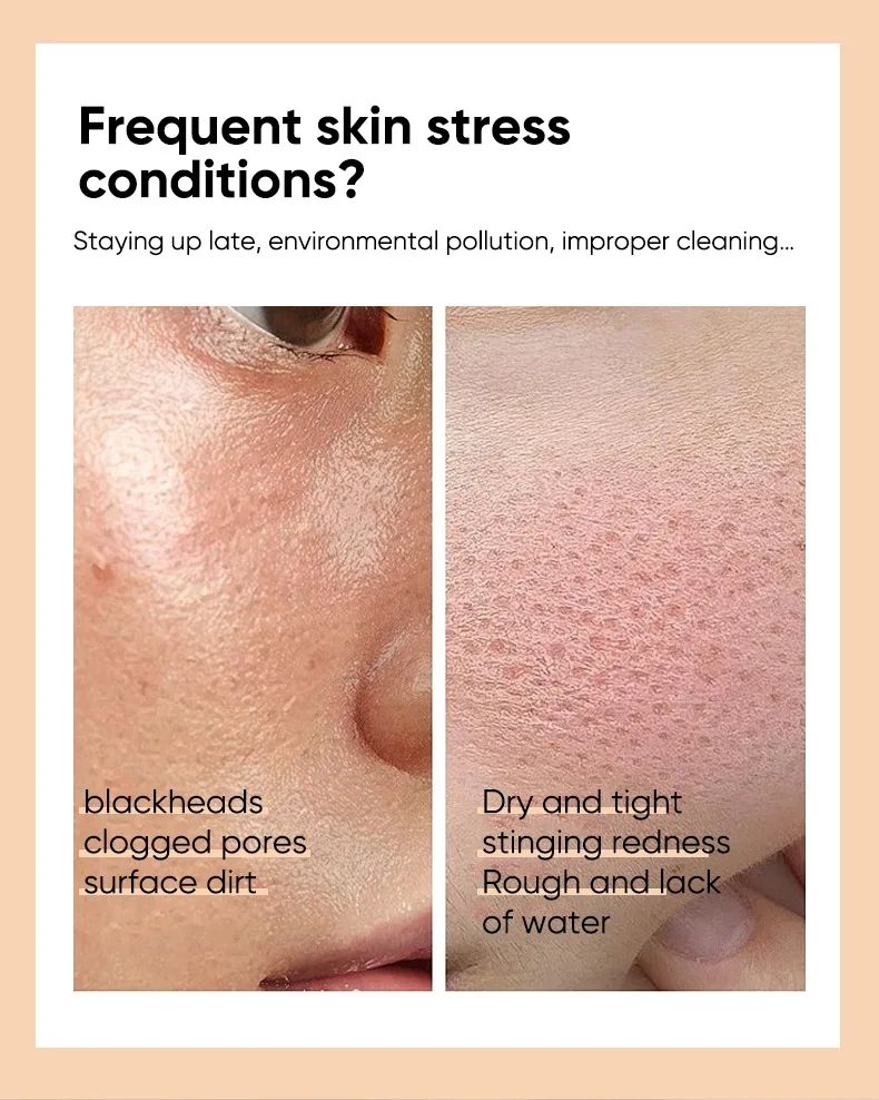 7% Glycolic Acid Exfoliating Toner Shrinks Pores, Repairs Facial Oil, Gentle Exfoliating and Refreshing Skin