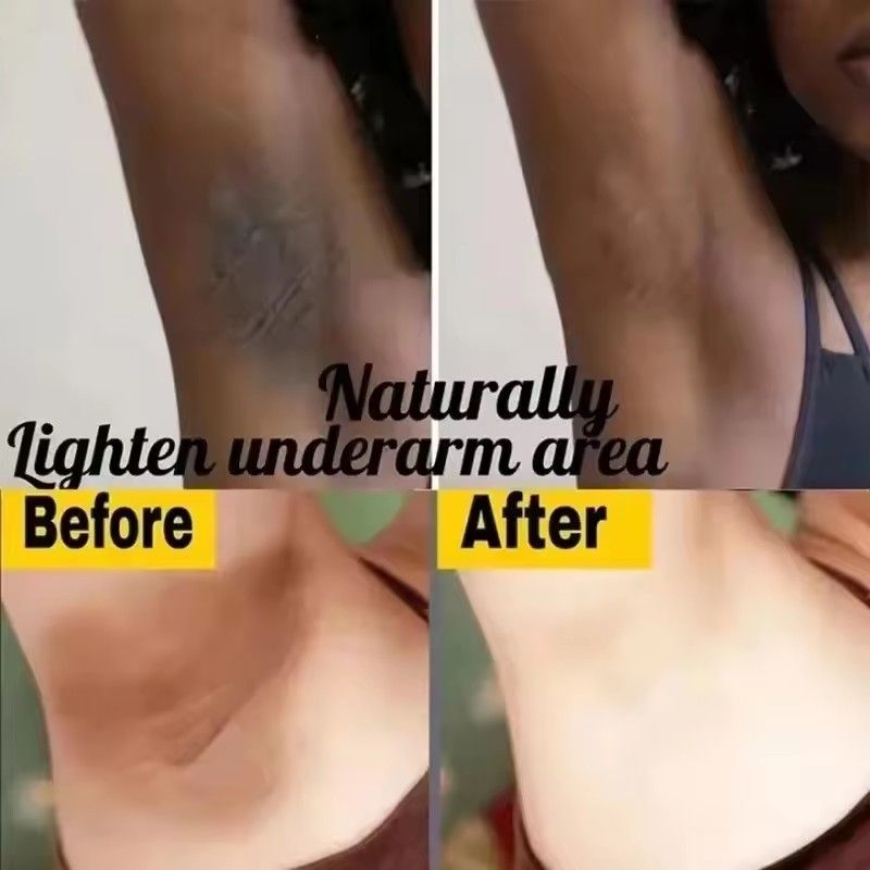 1PCWhitening Cream Private Parts Underarm Bleaching Serum Whiten Butt Knee Brighten Inner Thigh Intimate Parts Dark Remove Melanin