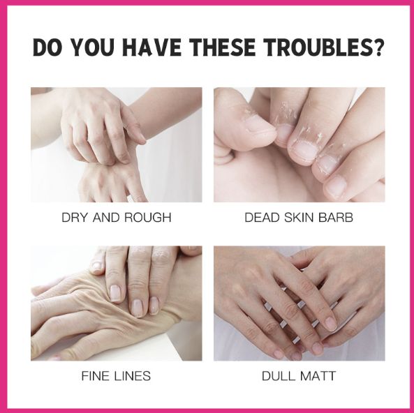 1PCS KORMESIC Fruit Vaseline Hand Cream Moisturizing Nourishing Anti-Wrinkles Anti-aging Hydrating Hands Skin Care Products