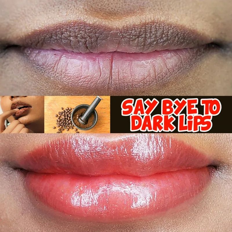 Lips Pink Cream Fresh Bleaching Treatment Remove Dark Smoke Lips Lip Balm Whitening Moisturizer Nourish Essence Dilute Melanin B2-916