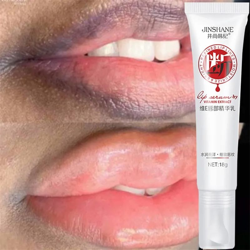 Lips Pink Cream Fresh Bleaching Treatment Remove Dark Smoke Lips Lip Balm Whitening Moisturizer Nourish Essence Dilute Melanin B2-916