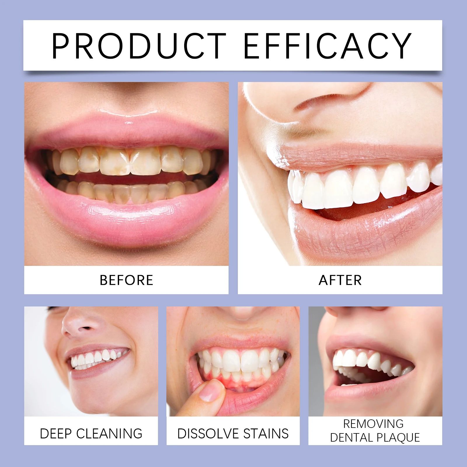 Manual Teeth Cleaner - Oral Odor & Tartar Removal, Portable Teeth Care Daily Dental Irrigator For Gentle Cleaning