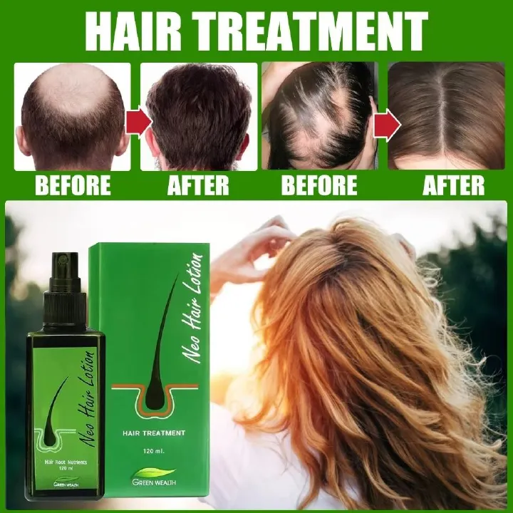 Original Thailand Neo Hair Lotion Paradise 120ml Hair Growth Oil Capillary Tonic For Growth Anti Hair Loss Scalp Treatments Men