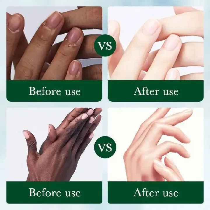 Fast Whitening Dark Knuckles Brighten Hand Cream Melanin Corrector Moisturizing Intense Stains Remover Cosmetics Skin Care