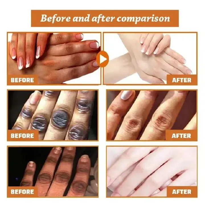 Fast Whitening Dark Knuckles Brighten Hand Cream Melanin Corrector Moisturizing Intense Stains Remover Cosmetics Skin Care