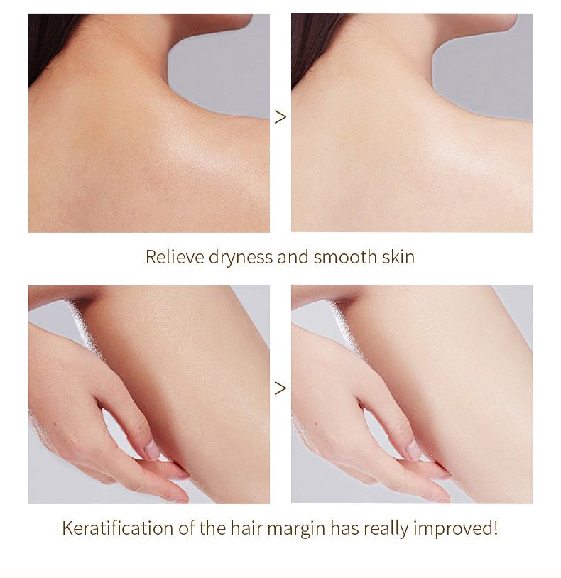 Exfoliating Gel, Moisturizer Face Body Scrub Gel,Deep Cleansing Moisturizing Facial Exfoliator,Natural Orange Peeling Gel Face Scrub Aqua Gel Gentle Exfoliator Clear and Softer Skin Brightening