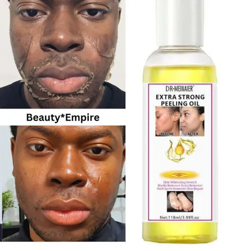 DR MEINAIER Extra Strong Peeling Oil is a powerful exfoliating and skin-lightening solution designed to remove dead skin cells,reduce the appearance of scars,stretch marks and dark spots and promotion