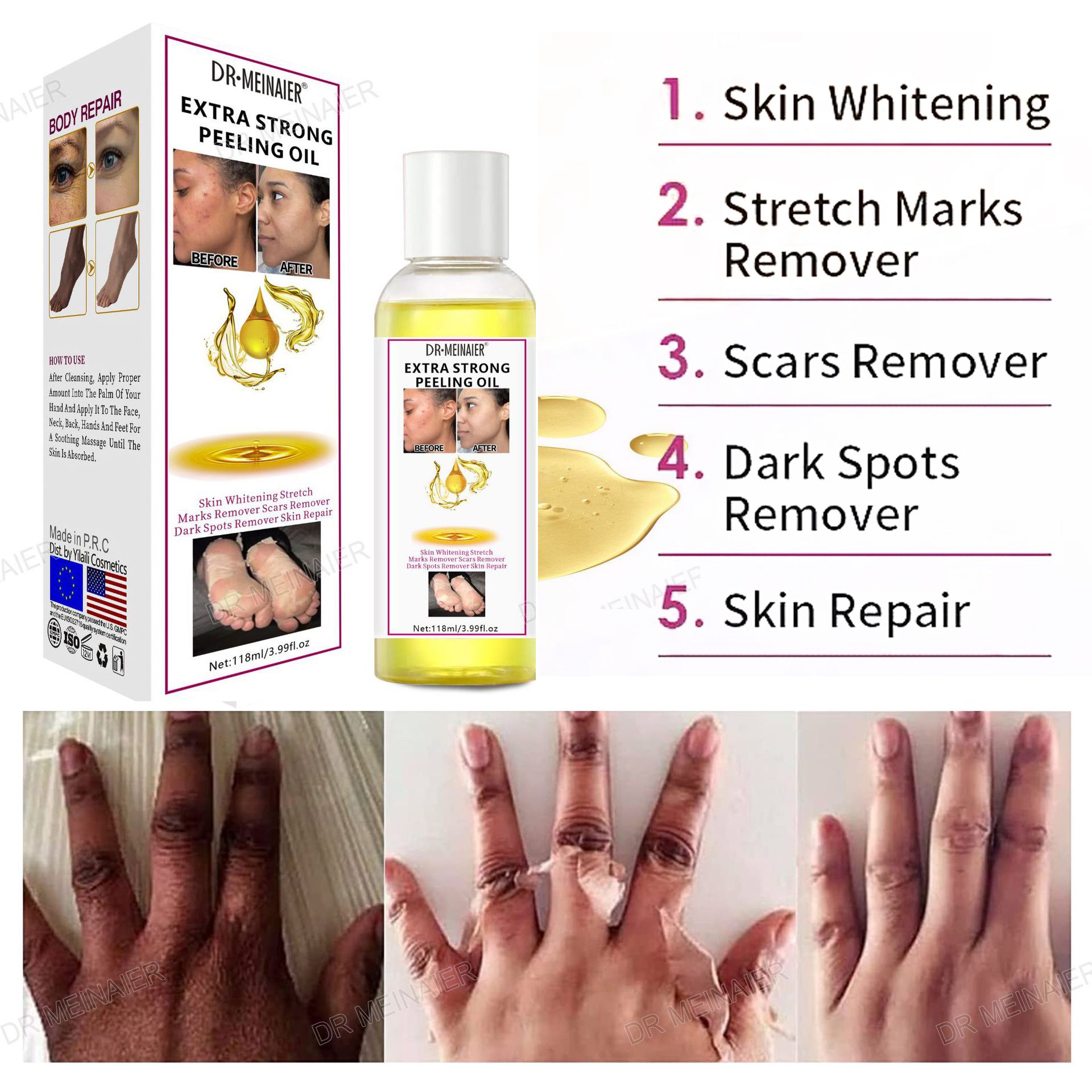 DR MEINAIER Extra Strong Peeling Oil is a powerful exfoliating and skin-lightening solution designed to remove dead skin cells,reduce the appearance of scars,stretch marks and dark spots and promotion