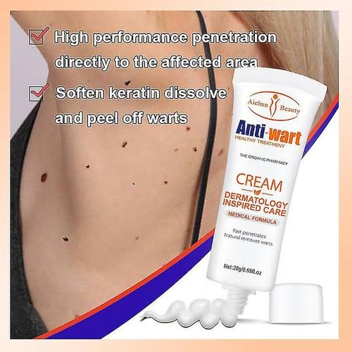 Aichun Beauty Anti-Wart Cream Warts Remover Cream Wart Treatment, Skin Tags & Light Moles Removal -20g