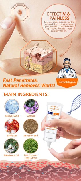 Aichun Beauty Anti-Wart Cream Warts Remover Cream Wart Treatment, Skin Tags & Light Moles Removal -20g
