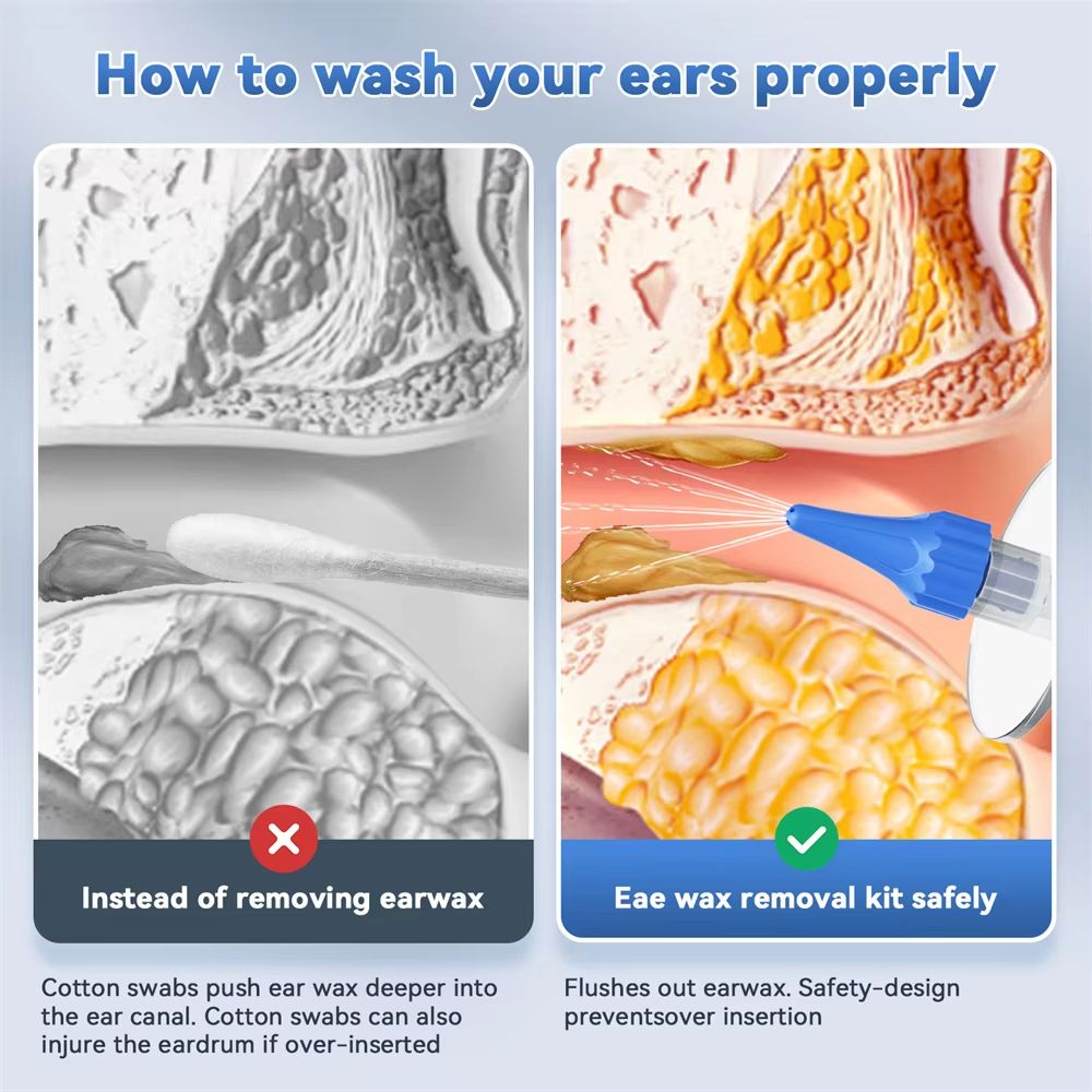 Ear Washer Ear Wax Removal Tool Ear Infection Cleaning With 10 Replacement Tips Ear Cleaner For Adults Ear Irrigator Ear Care