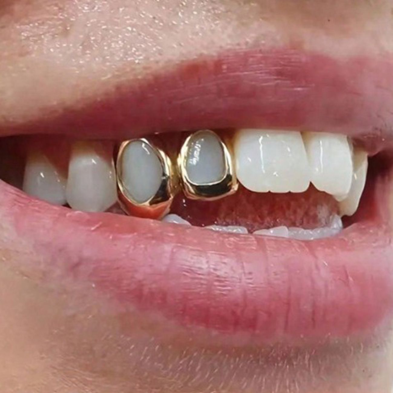 Luxurious Gold/silver Teeth Grillz Set for Hip Hop Style gold teeth silver teeth gold grillz silver grillz