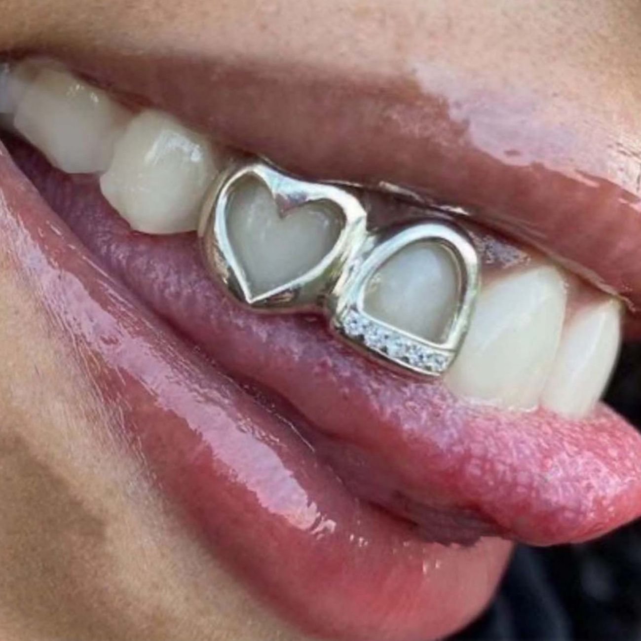 Adorable Shiny Gold & Silver Heart Cutout Diamond Accent Grillz【for Women & Teens on Special Occasions】