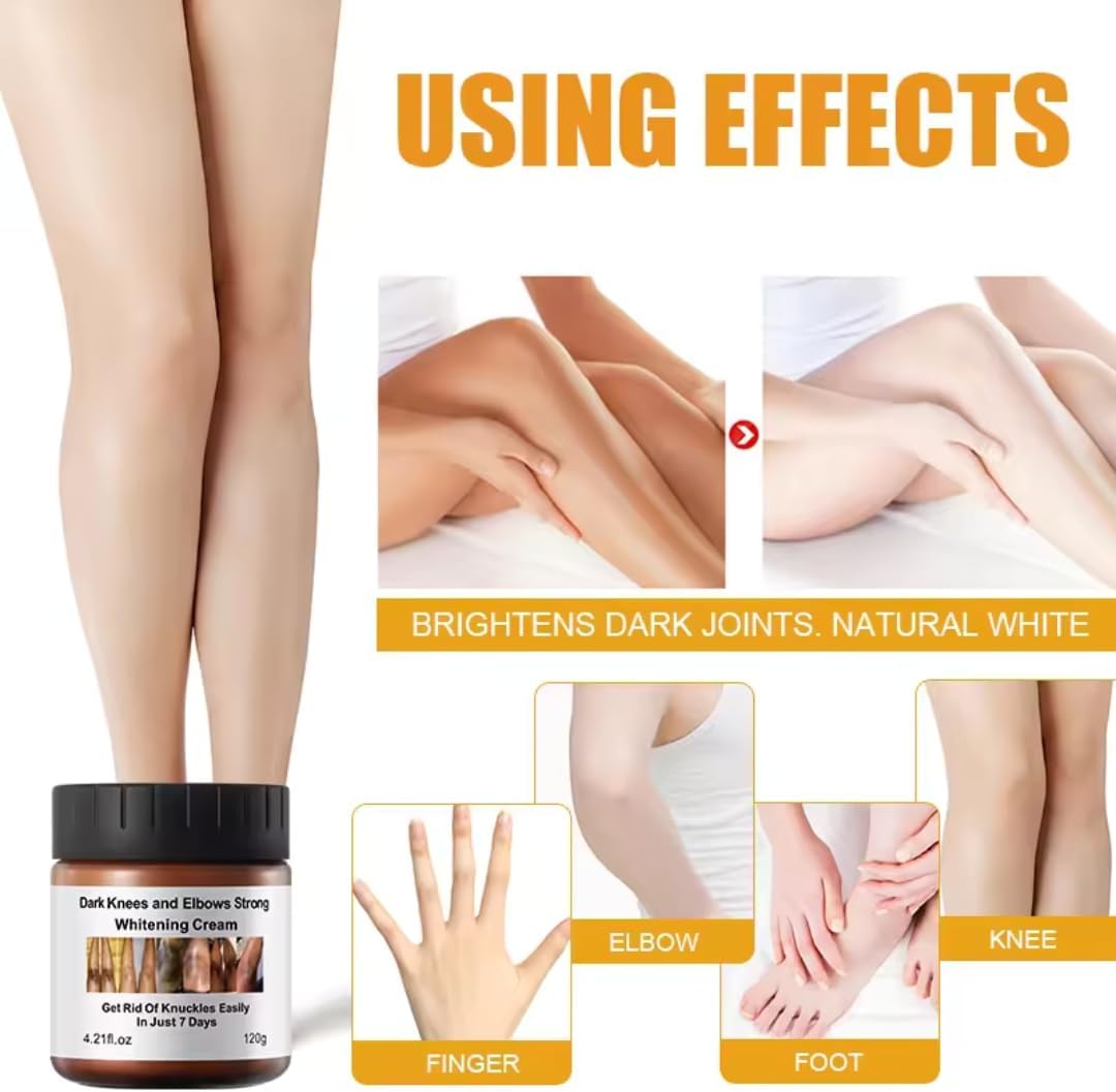 Mooyam Dark Knees & Elbows Whitening Cream 120g – Underarm, Armpit & Knuckle Brightening, Dark Spot Remover, Moisturizing Skin Care for Men & Women