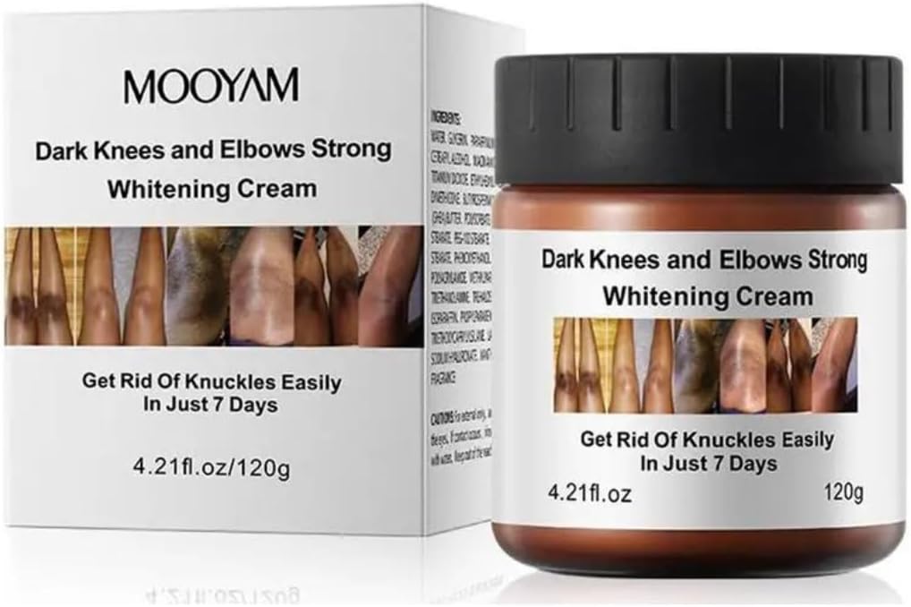 Mooyam Dark Knees & Elbows Whitening Cream 120g – Underarm, Armpit & Knuckle Brightening, Dark Spot Remover, Moisturizing Skin Care for Men & Women