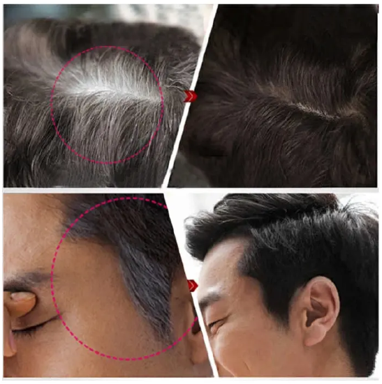 INSTANT GRAY HAIR COVER STICK – QUICK ROOT TOUCH-UP PEN (BLACK BROWN)