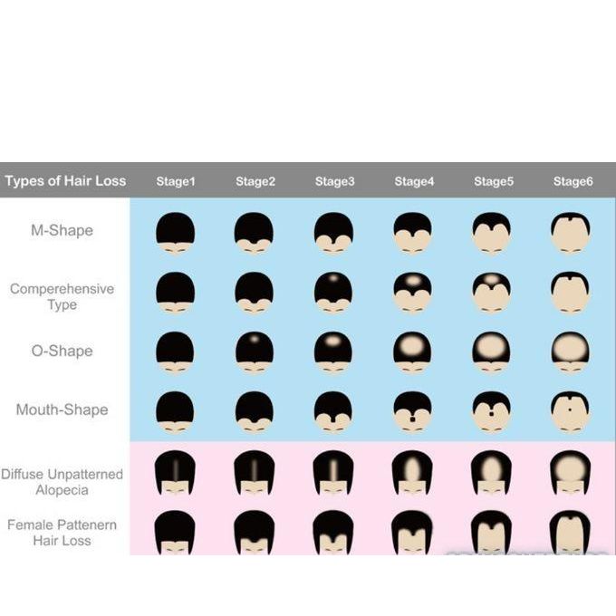 Kirkland Minoxidil 5% Extra Strength Hair Loss Regrowth System Treatment For Men Beard Care Oil Premium Topical Solution Growth Nourishing Serum 6 Bottle Of 60ml (6 Months Supply)