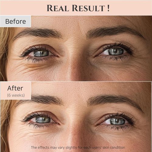 Beauty of Joseon Revive Eye Serum with Retinal Niacinamide Correction for Puffy Eye Bags Fine Lines Dark Circles Wrinkles, Korean Skin Care 30ml