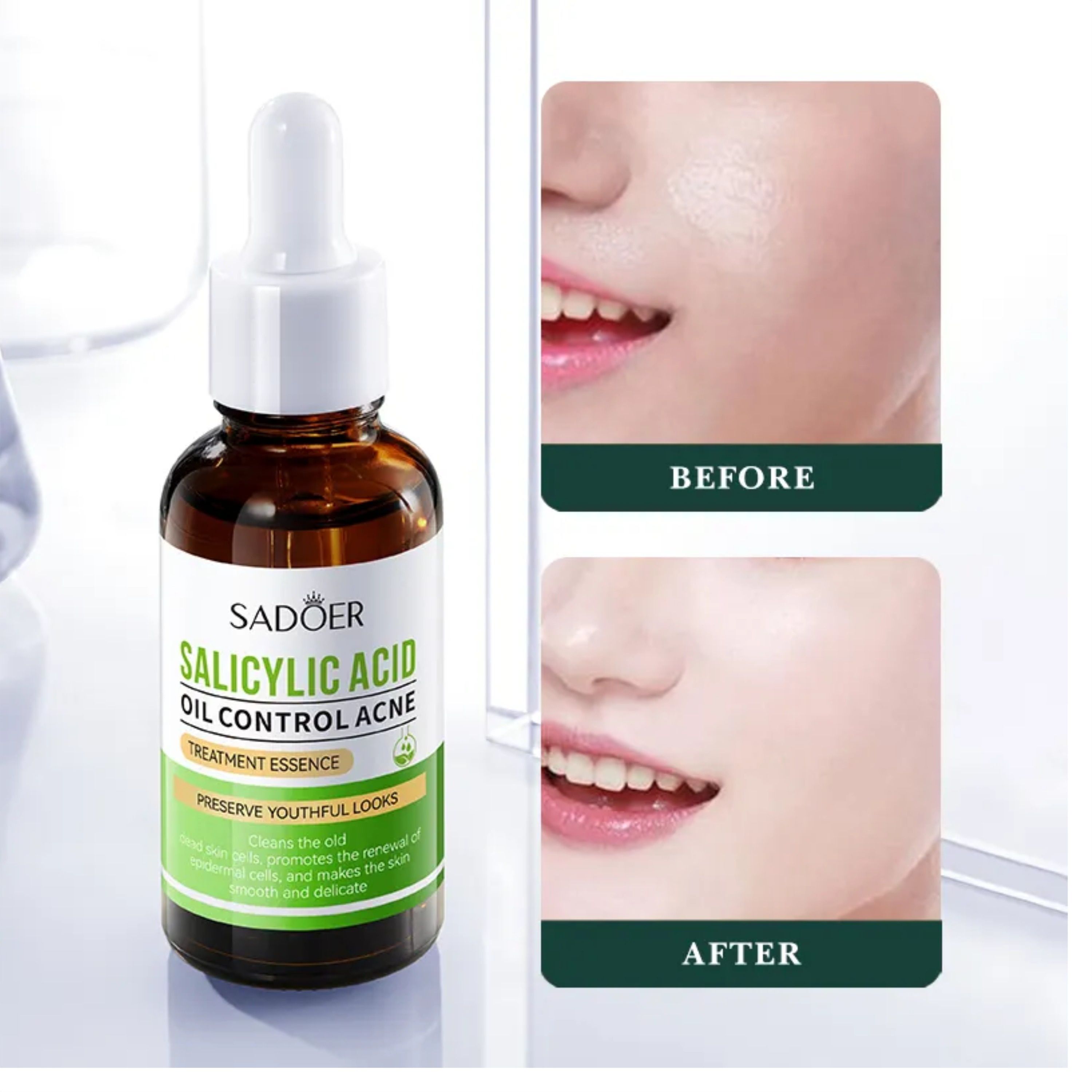 SADOER 3 in 1, Salicylic Acid Acne Treatment Essence + Niacinamide Brightening Serum + Vitamin C Brightening Essence Anti Acne, Whiten Freckles, Removes Blackheads, Control Oil, Face Brightening