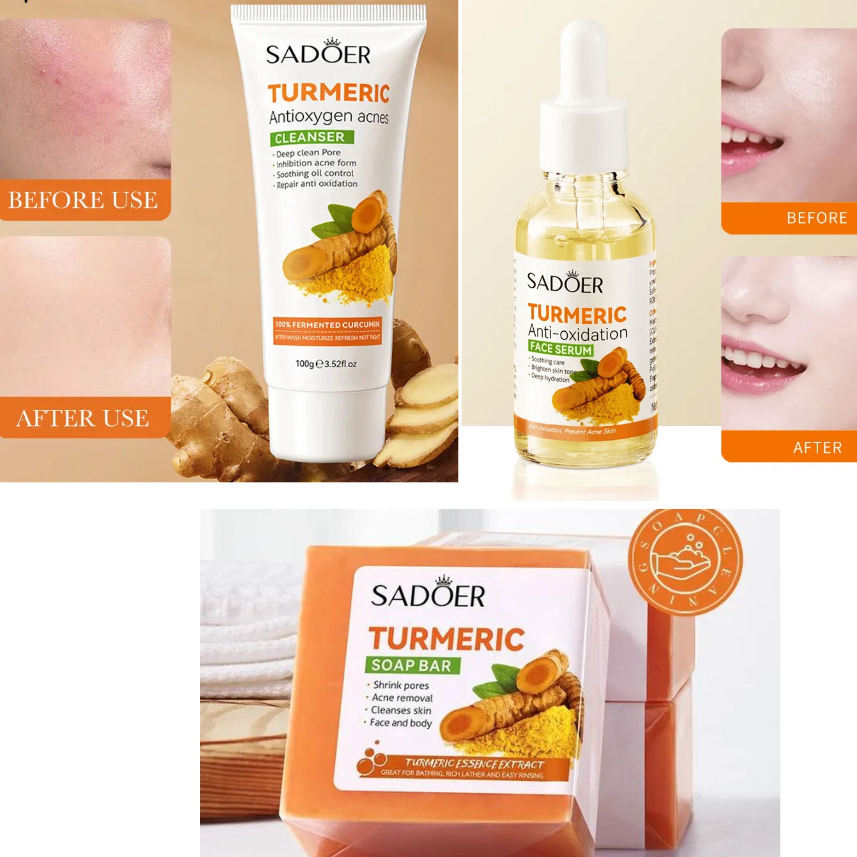 Sadoer 3 in 1 Turmeric Set, Turmeric Serum + Tumeric Cleanser + Tumeric Soap, Anti Oxidation Like Vitamin C, Anti Acne, Pore Shrinking, Deep Hydration and Oil Control