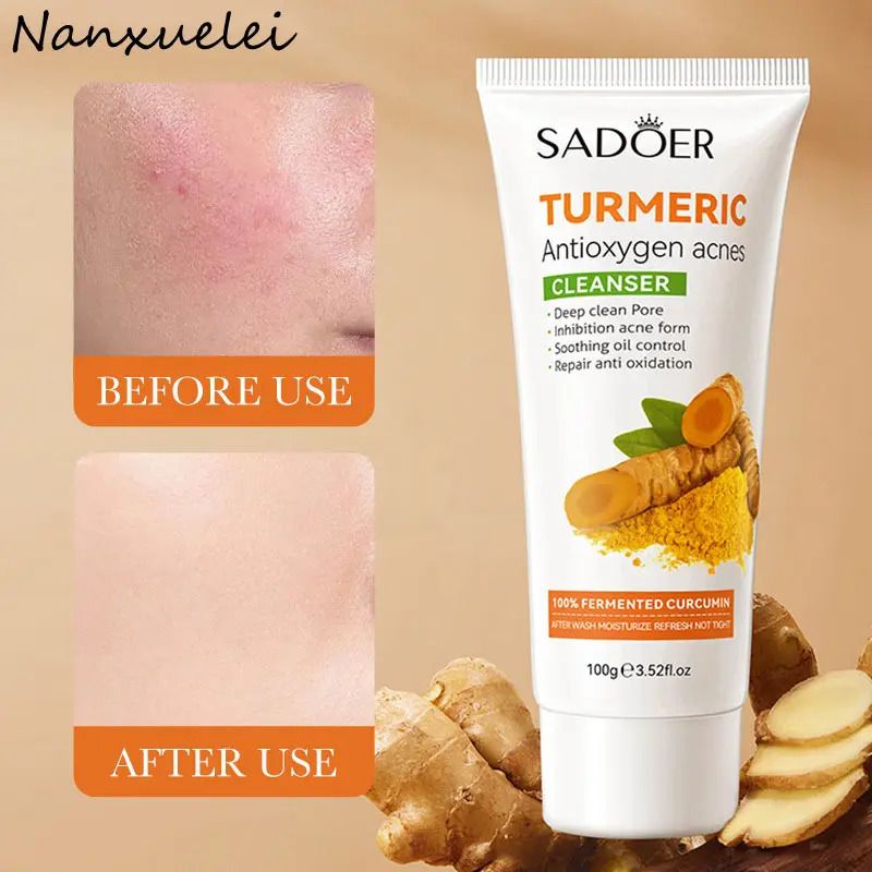 Sadoer  5 in 1 Turmeric Set, Tumeric Toner + Face Serum +Face Cleanser + Face Cream + Tumeric Soap, with unparelled Vitamin C capabilities, Helps in Preven Acne, Sooth, Hydrate, Lighjten Acne Marks