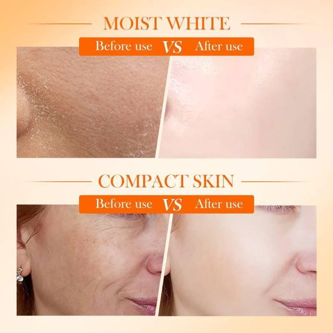 Sadoer 2 in 1 Skin Active 5x Vitamin C Cream +  5 x Vitamin C Serum Complementary, For Deep Hydration, Whitening Dark Spots, Moisturizing, Skin Tone Brightening and Skin Nourishment