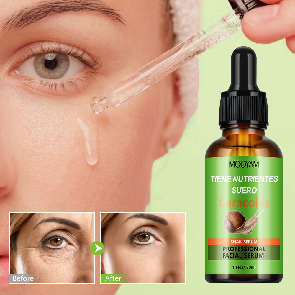 MOOYAM Snail Serum, Snail Secretion Filtrate For Moisturizing, Smoothing and Moisturizing Snail Filtrate Serum, Like Vitamin C,Anti Wrinkles, Anti Aging, Moisturizing, hydrating