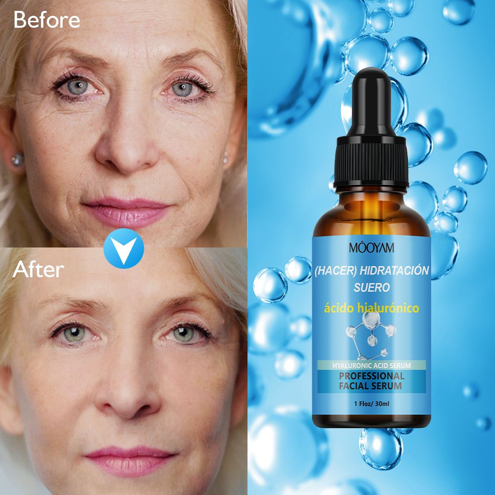 MOOYAM Hyaluronic Acid Serum, Super Antioxidant , can Add Vitamin C Moisturising, with Vitamin C and E, Improve Skin Desity