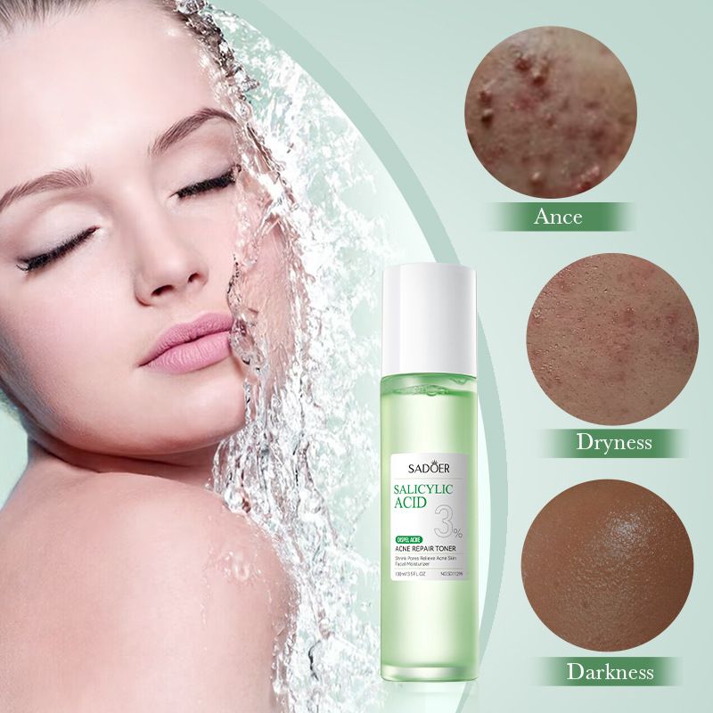 Sadoer 4 in 1 Set, Salicylic Acid 3% Dispel Acne, Acne Repair Toner + Serum + Cream + Cleanser, Gentle Amino Acid Cleanser, (Can use Together with Vitamin C), Removes Acne, Moisturize, Rejuvenate, Rep