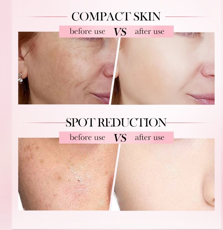 Sadoer 2 in 1 Set of 4 in 1 Face Serum + Face Cream, Contains Vitamin C, Nicotinamide (Niacinamide), Hyaluronic and Vitamin E, Purify Skin, Brighten Skin Tone, Moisturizing, Repair and Nourish Set