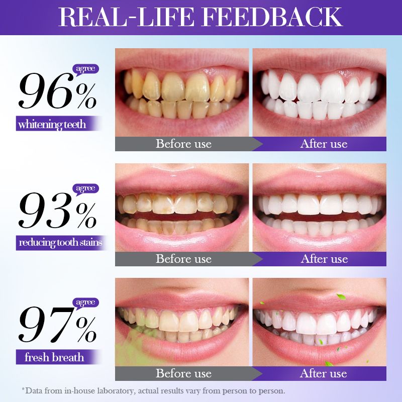 SADOER Teeth Whitenining Toothpaste, V34 Teeth Whitener, Clean Teeth, Fresh Breath, Tooth Stain Removal