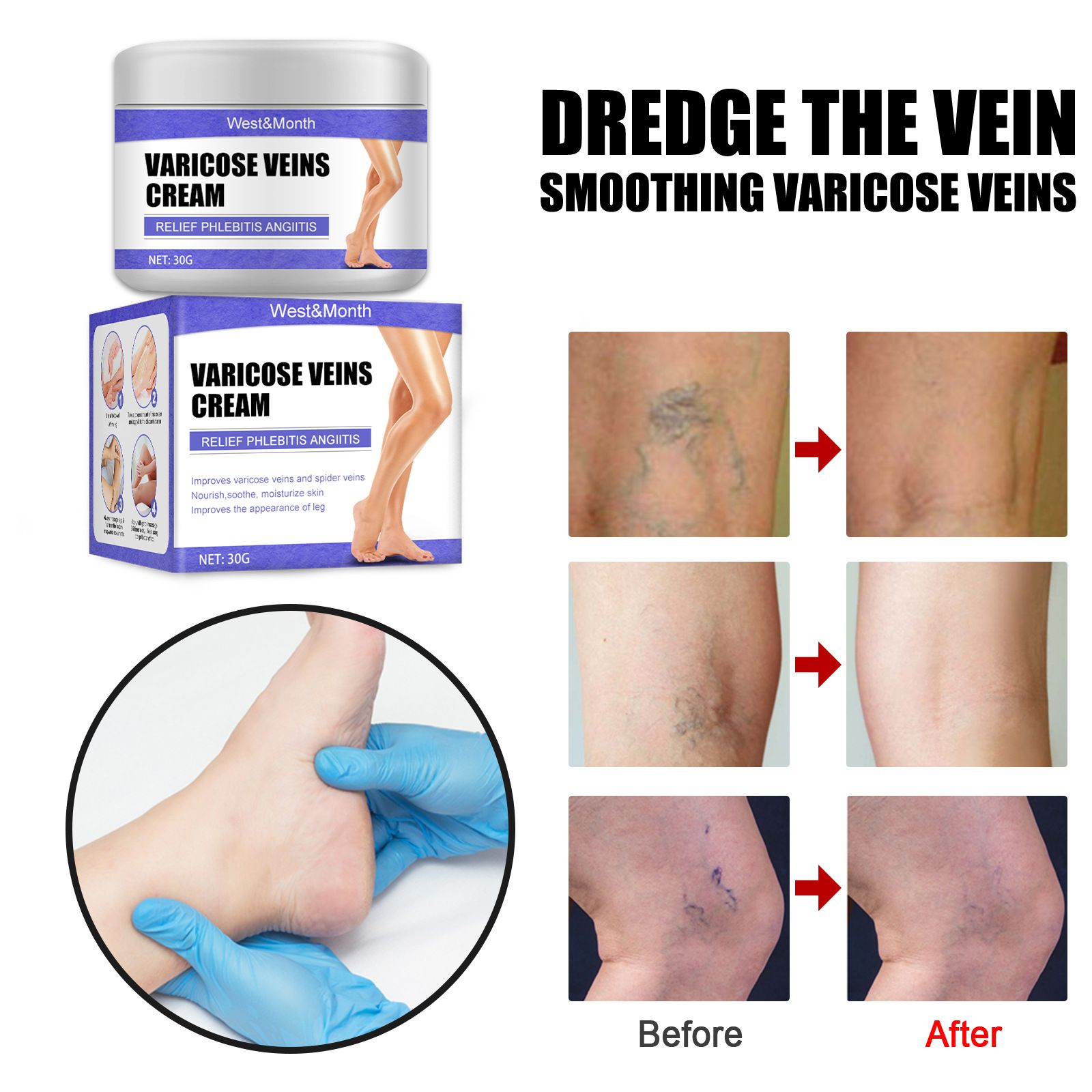 Vein Repair Cream Leg Varicose Earthworm Leg Blue Veins Bulge Pain Maikang Leg Care Cream B2-769
