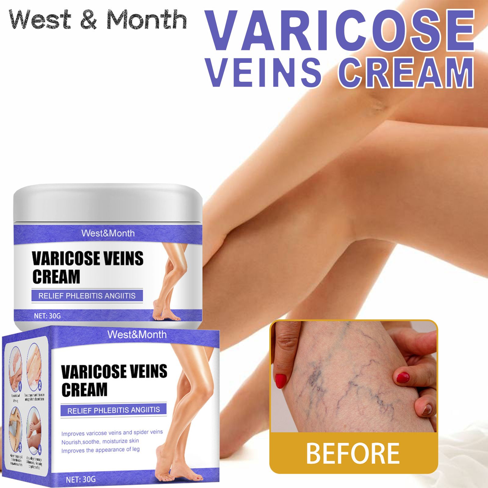 Vein Repair Cream Leg Varicose Earthworm Leg Blue Veins Bulge Pain Maikang Leg Care Cream B2-769