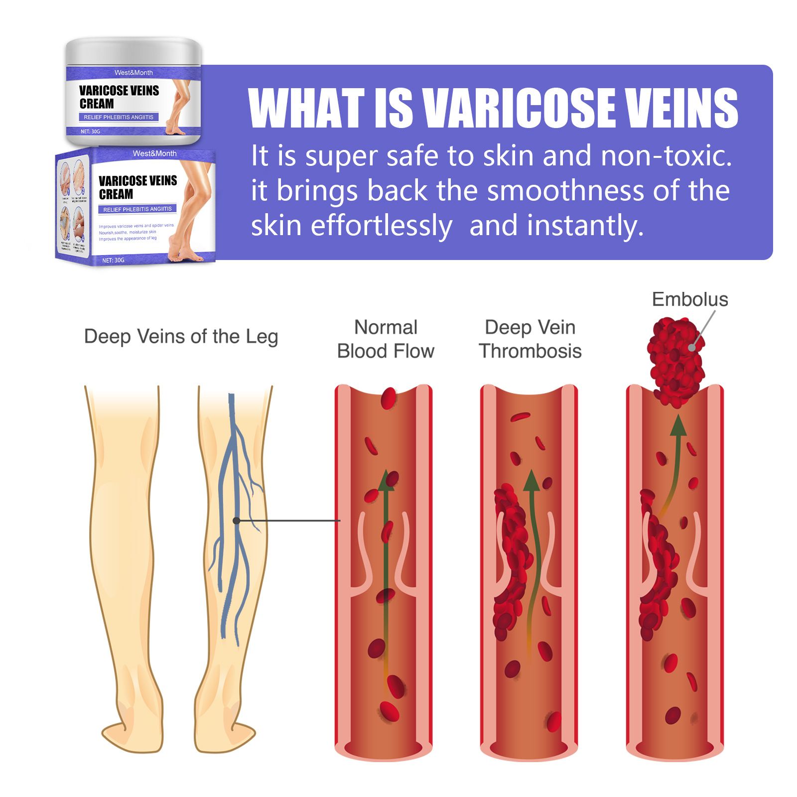 Vein Repair Cream Leg Varicose Earthworm Leg Blue Veins Bulge Pain Maikang Leg Care Cream B2-769