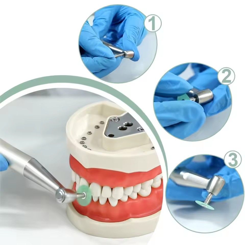 Teeth whitening veneers, polishing pads, resin polishing ceramic veneers, 80 pieces per box of dental polishing discs