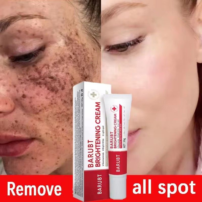 BARUBT Powerful bleaching cream removing stains, lightens the skin, quickly removes melanin pigmentation, melasma, dark spots