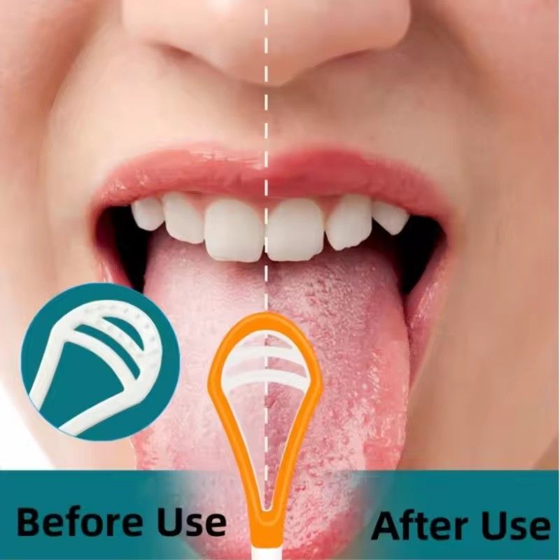 Tongue Cleaner for Professional Tongue Cleaner, Oral Care Tools, Adult Reusable Double-sided Tongue Cleaning Scraper Brush