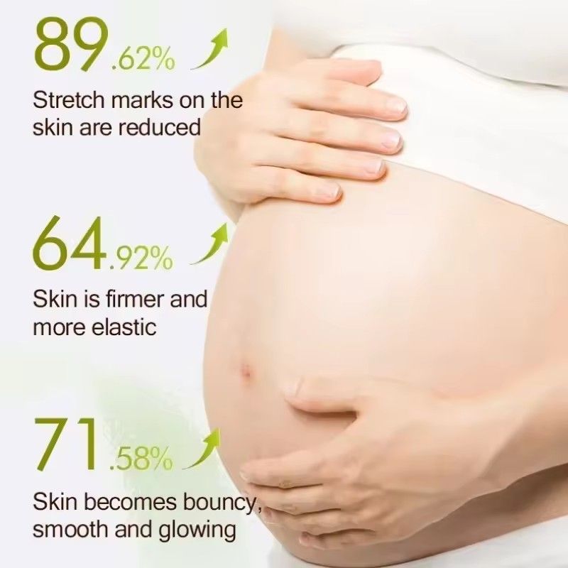 1PC   Stretch Mark Vanishing Cream Remove Body Buttock Breast Marks Effective Treatment Repair Maternity Loose Firming Skin Care