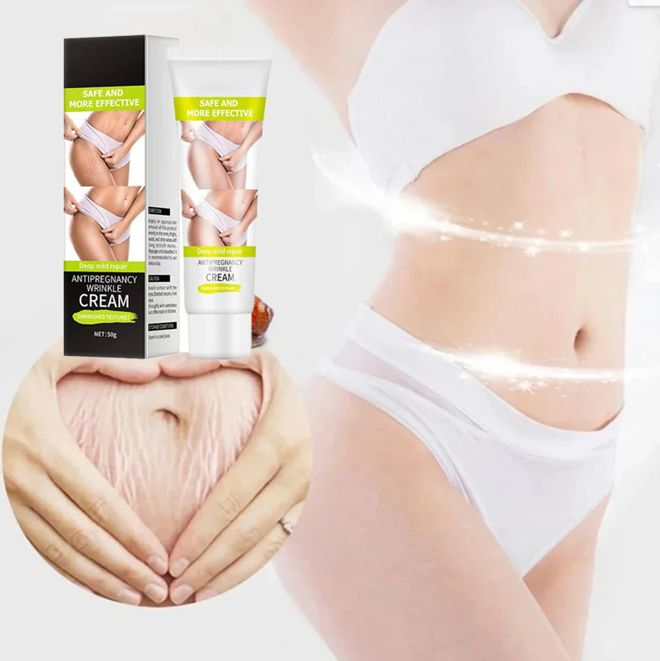 1PC   Stretch Mark Vanishing Cream Remove Body Buttock Breast Marks Effective Treatment Repair Maternity Loose Firming Skin Care
