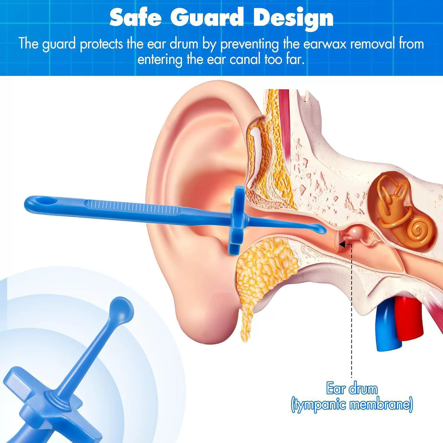 2 Pcs Earwax Removal Tool, Earwax Removal Kit With Safe Guard, Reusable Plastic Earwax Removal Cleaning Tool
