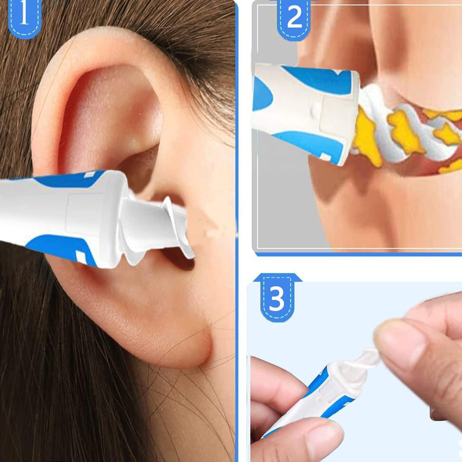 Ear Wax Remover, Q Grips Earwax Removal-Spiral Ear Wax Removal Tool, Reusable Earwax Removal Kit Safe Ear Cleaner with Soft and Flexible Replacement