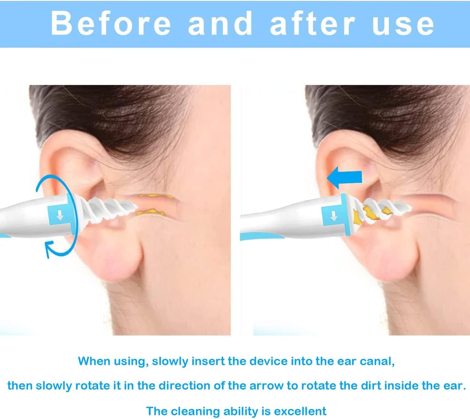 Ear Wax Remover, Q Grips Earwax Removal-Spiral Ear Wax Removal Tool, Reusable Earwax Removal Kit Safe Ear Cleaner with Soft and Flexible Replacement