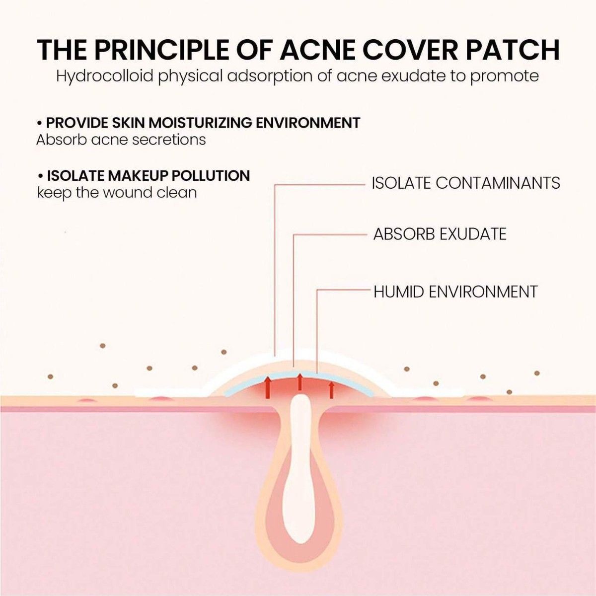 Pimple Patch for Shrinking Zits and Whiteheads in 1 use; Nighttime Spot Stickers for Face and Skin Treatment for Breakouts, Absorbs Zits & Blemish Acne Patches, Hydrocolloid Patches