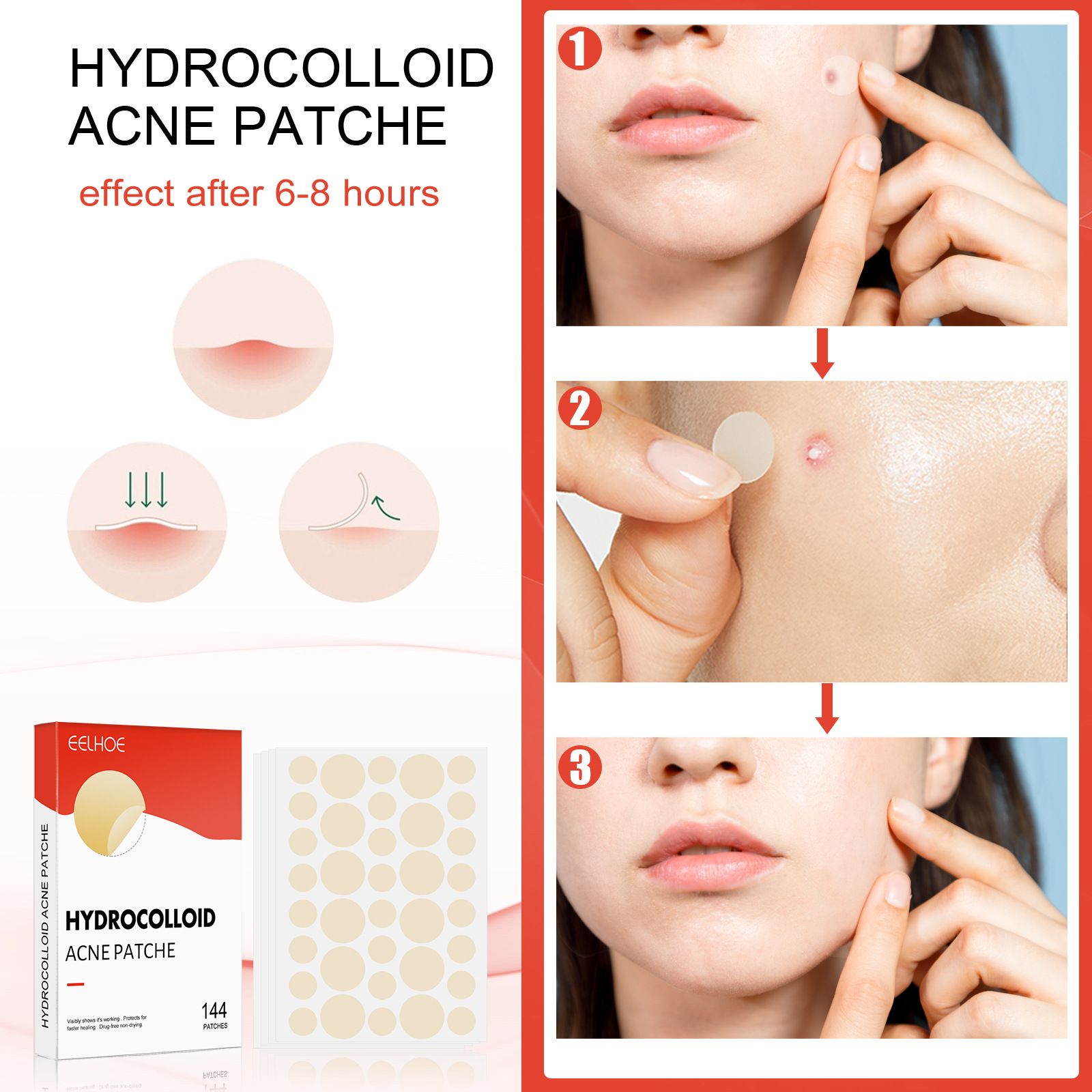 Pimple Patch for Shrinking Zits and Whiteheads in 1 use; Nighttime Spot Stickers for Face and Skin Treatment for Breakouts, Absorbs Zits & Blemish Acne Patches, Hydrocolloid Patches
